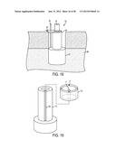 SYSTEM AND METHOD FOR PREVENTION AND TREATMENT OF PERI-IMPLANT INFECTION diagram and image