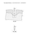 SYSTEM AND METHOD FOR PREVENTION AND TREATMENT OF PERI-IMPLANT INFECTION diagram and image