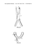 SYSTEM AND METHOD FOR PREVENTION AND TREATMENT OF PERI-IMPLANT INFECTION diagram and image