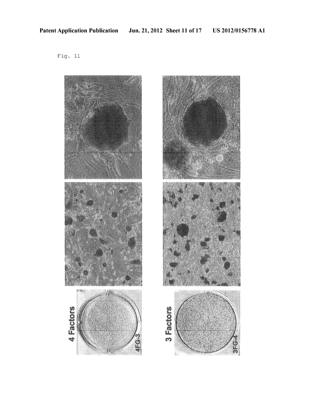 METHOD FOR EFFICIENT PRODUCTION OF INDUCED PLURIPOTENT STEM CELLS     UTILIZING CELLS DERIVED FROM ORAL MUCOSA - diagram, schematic, and image 12