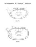 STRIKING FACE OF A GOLF CLUB HEAD diagram and image