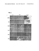 METHOD FOR DETERMINING THE RISK OF DEVELOPING BRAIN METASTASIS, AND A KIT     TO CARRY OUT SAID METHOD diagram and image