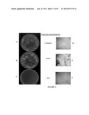 NODULE SPECIFIC MEDICAGO PEPTIDES HAVING ANTIMICROBIAL ACTIVITY AND     PHARMACEUTICAL COMPOSITIONS CONTAINGING THE SAME diagram and image