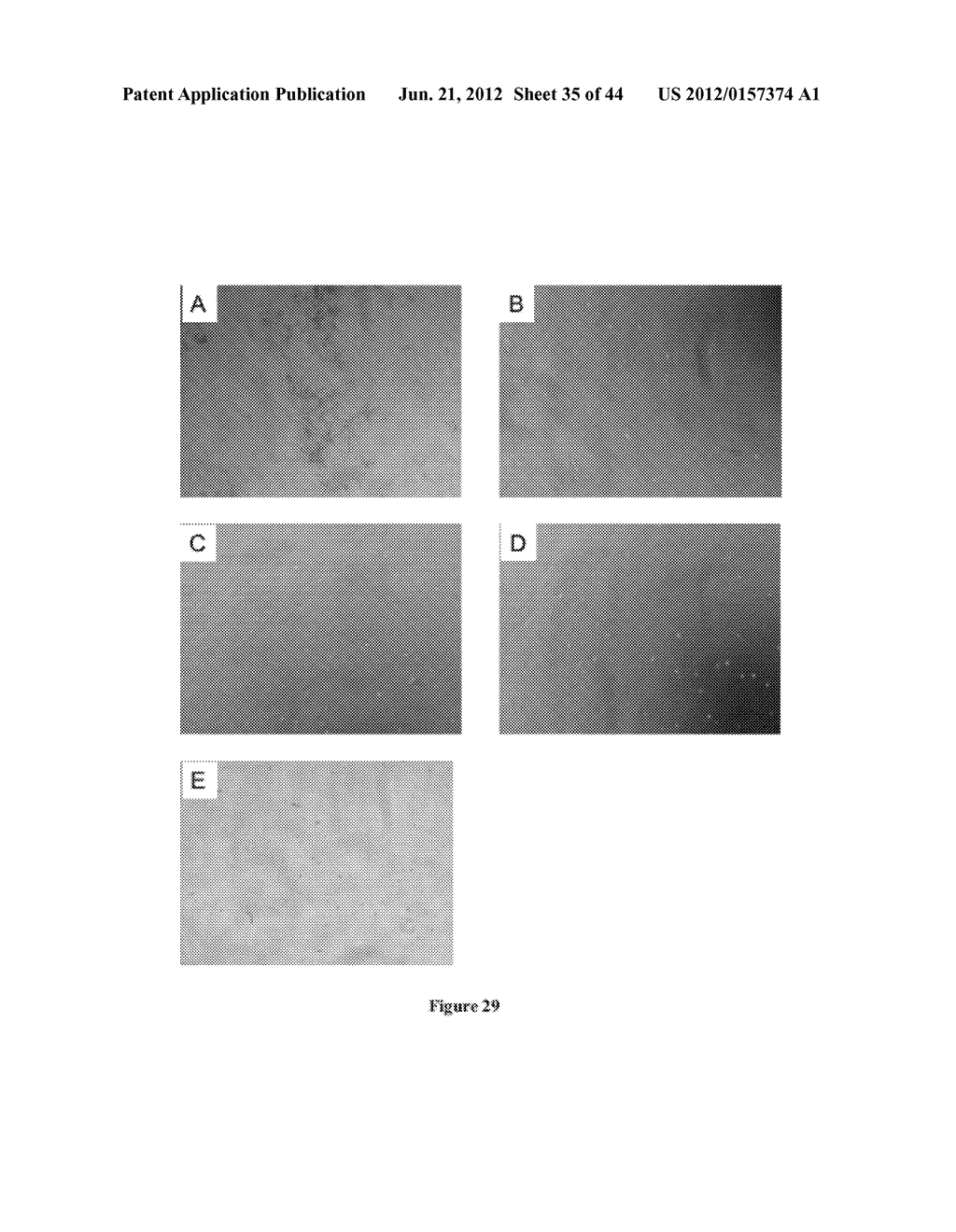 NODULE SPECIFIC MEDICAGO PEPTIDES HAVING ANTIMICROBIAL ACTIVITY AND     PHARMACEUTICAL COMPOSITIONS CONTAINGING THE SAME - diagram, schematic, and image 36