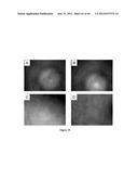 NODULE SPECIFIC MEDICAGO PEPTIDES HAVING ANTIMICROBIAL ACTIVITY AND     PHARMACEUTICAL COMPOSITIONS CONTAINGING THE SAME diagram and image