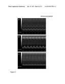 COMPOSITIONS AND METHODS FOR CARDIAC TISSUE REPAIR diagram and image