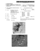 NOVEL THIOPHENE COMPOUNDS FOR USE IN THERAPY diagram and image