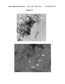 NOVEL THIOPHENE COMPOUNDS FOR USE IN THERAPY diagram and image