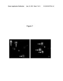 NOVEL THIOPHENE COMPOUNDS FOR USE IN THERAPY diagram and image