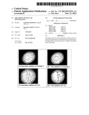 TREATMENT OF MACULAR DEGENERATION diagram and image