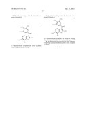 TREATMENT OF MACULAR DEGENERATION diagram and image