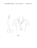 TRANSCUTANEOUS ENERGY TRANSFER SYSTEM WITH MULTIPLE SECONDARY COILS diagram and image