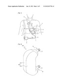 VENTRICULAR ASSIST DEVICE diagram and image