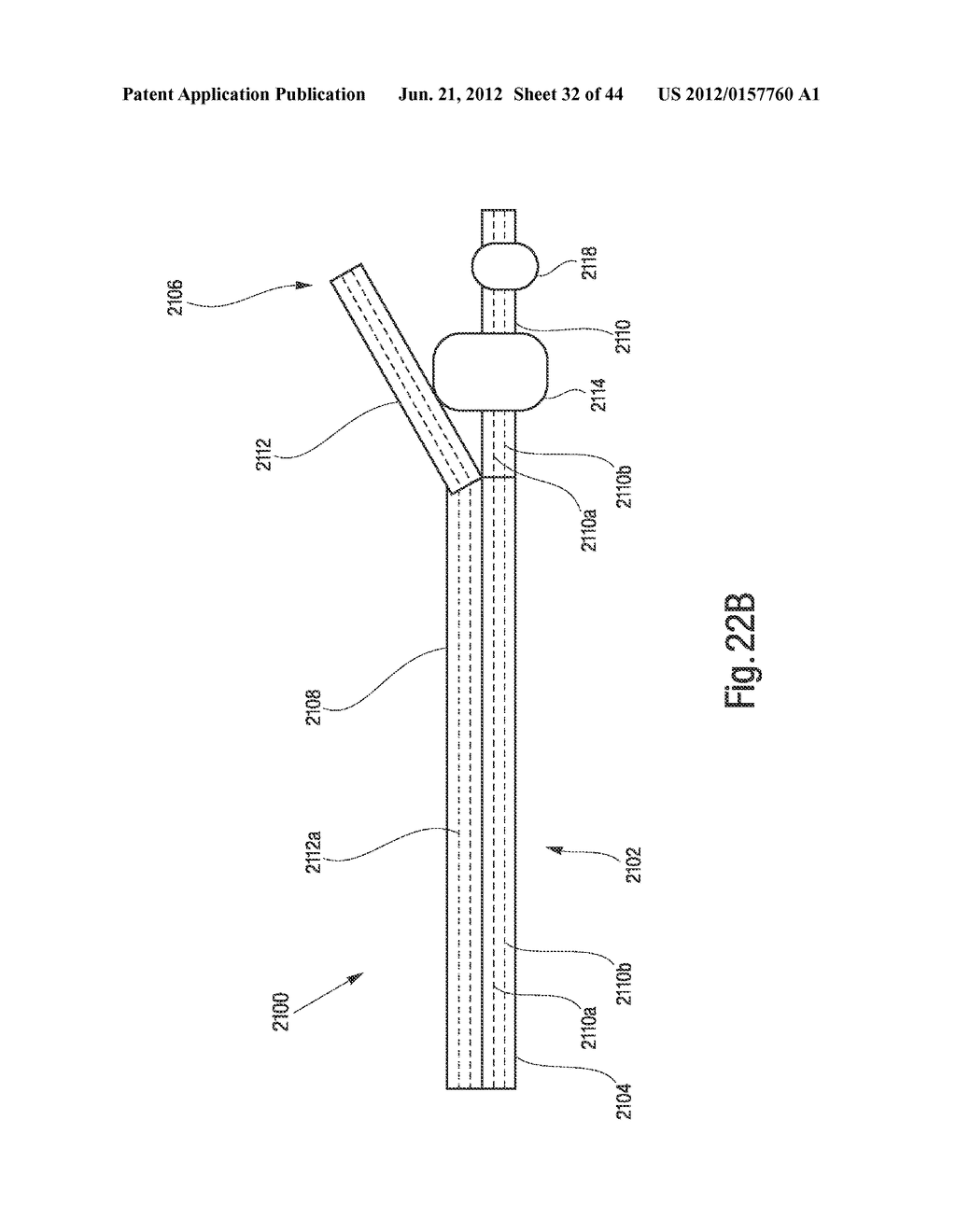 Tissue Restraining Devices and Methods of Use - diagram, schematic, and image 33