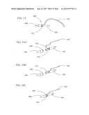 Endoscopic Suturing System With Retained End Cap diagram and image