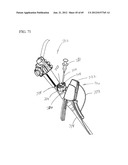 Endoscopic Suturing System With Retained End Cap diagram and image