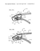 Endoscopic Suturing System With Retained End Cap diagram and image