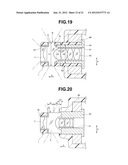 ENDOSCOPE diagram and image