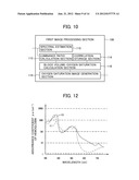 ENDOSCOPE APPARATUS diagram and image