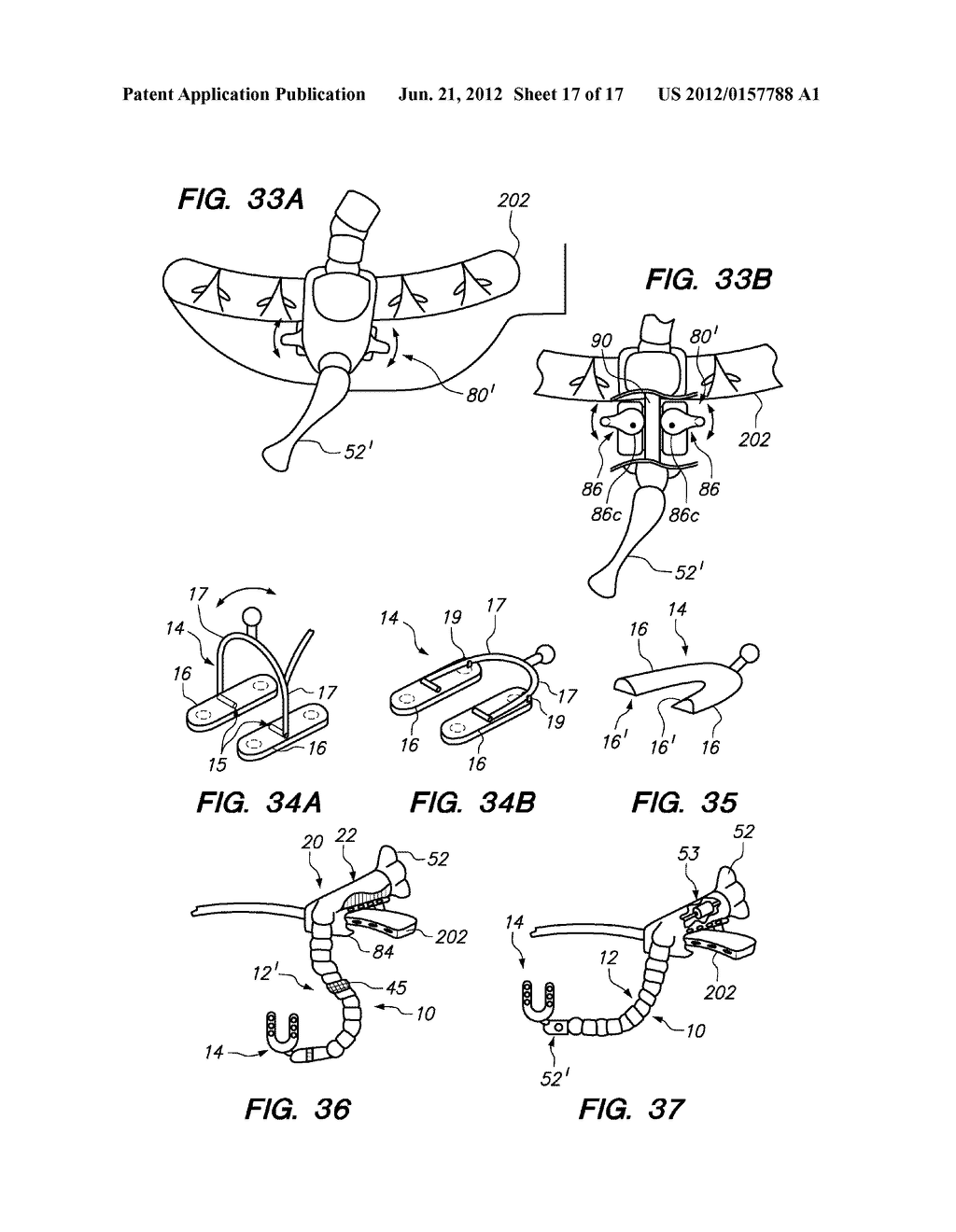 SURGICAL INSTRUMENTS, SYSTEMS AND METHODS OF USE - diagram, schematic, and image 18