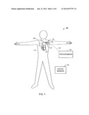 DETECTING HEART FAILURE BY MONITORING THE TIME SEQENCE OF PHYSIOLOGICAL     CHANGES diagram and image