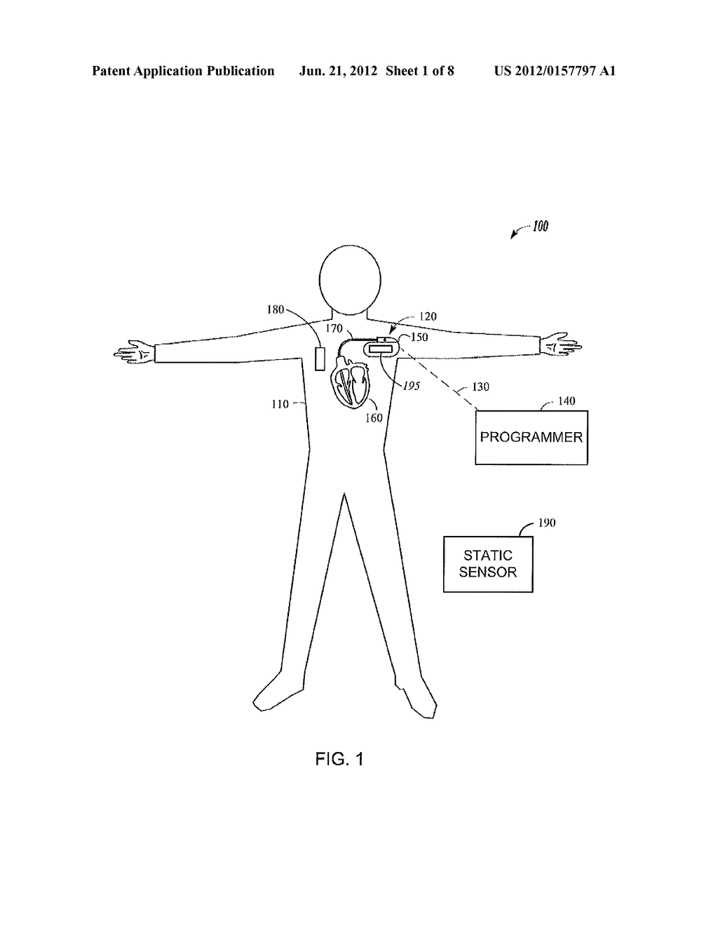 DETECTING HEART FAILURE BY MONITORING THE TIME SEQENCE OF PHYSIOLOGICAL     CHANGES - diagram, schematic, and image 02