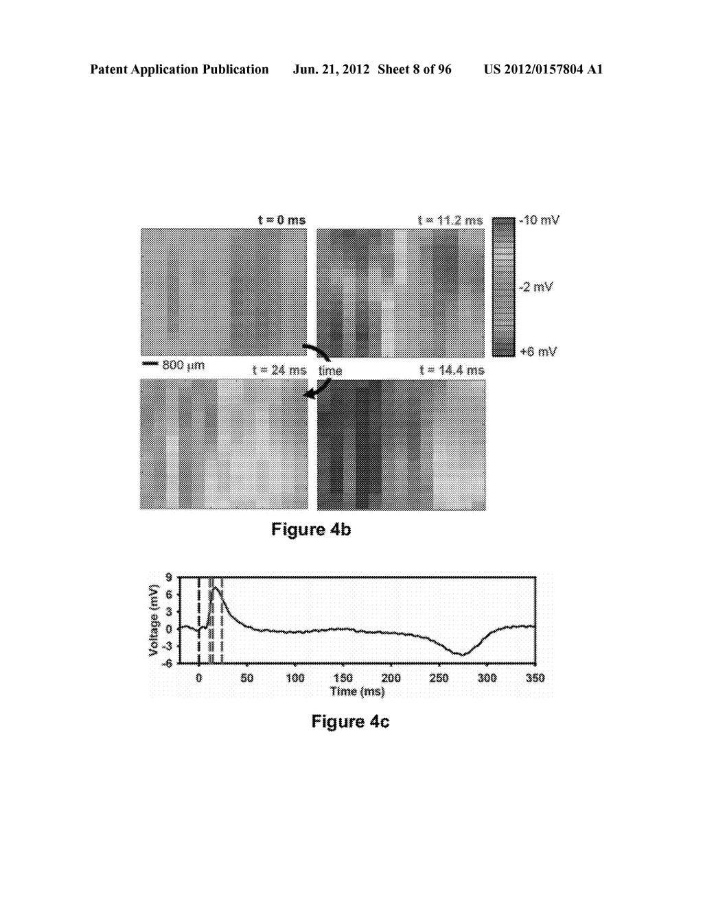 High-Speed, High-Resolution Electrophysiology In-Vivo Using Conformal     Electronics - diagram, schematic, and image 09