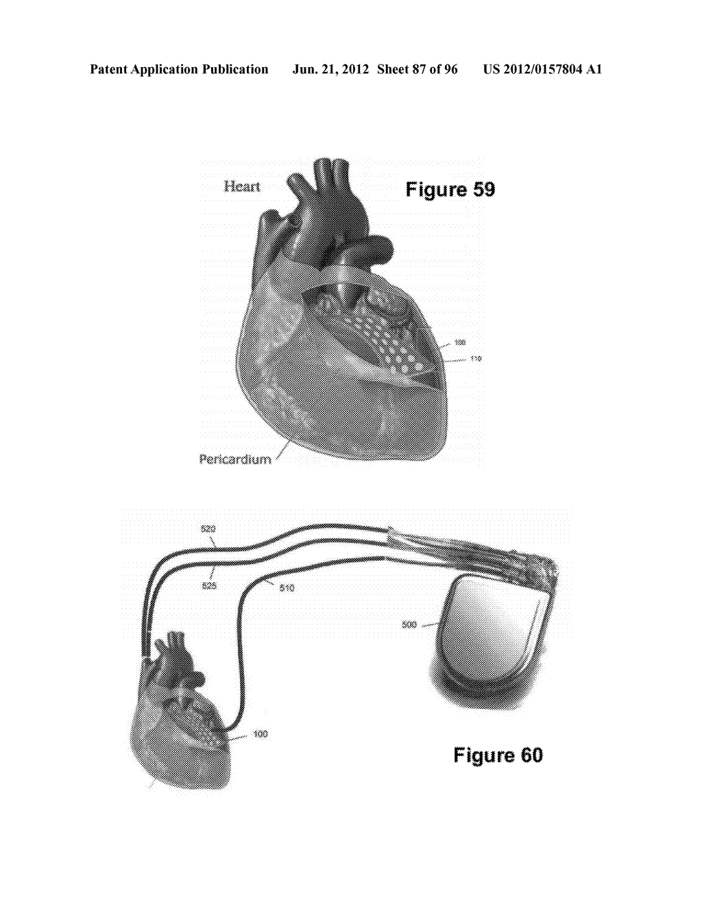 High-Speed, High-Resolution Electrophysiology In-Vivo Using Conformal     Electronics - diagram, schematic, and image 88