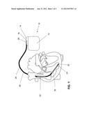 IMPLANTABLE DEVICE diagram and image