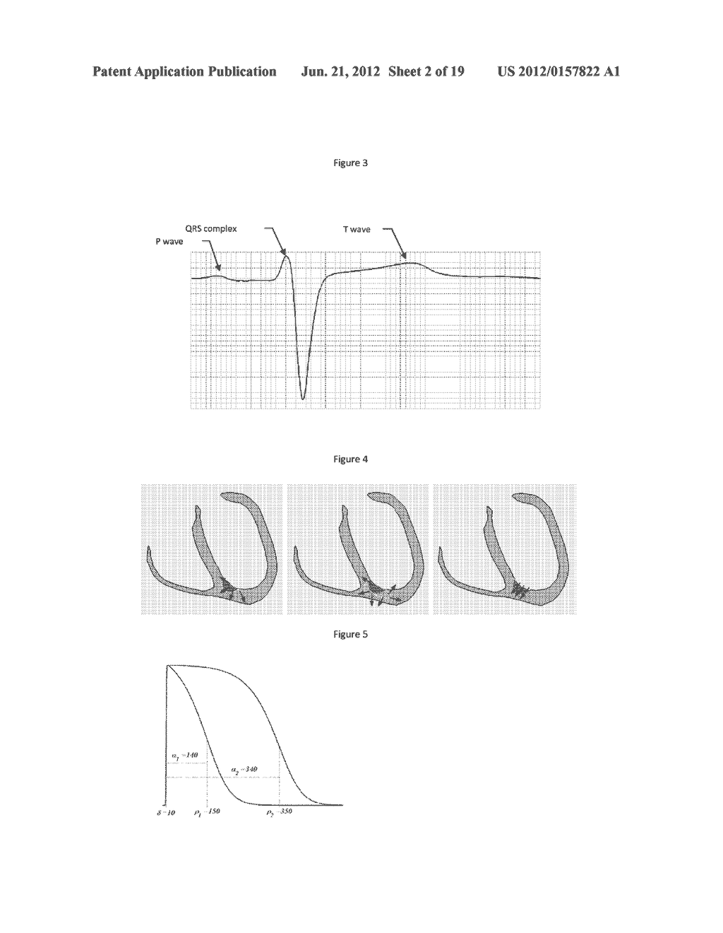 Inverse Imaging of Electrical Activity of a Heart Muscle - diagram, schematic, and image 03