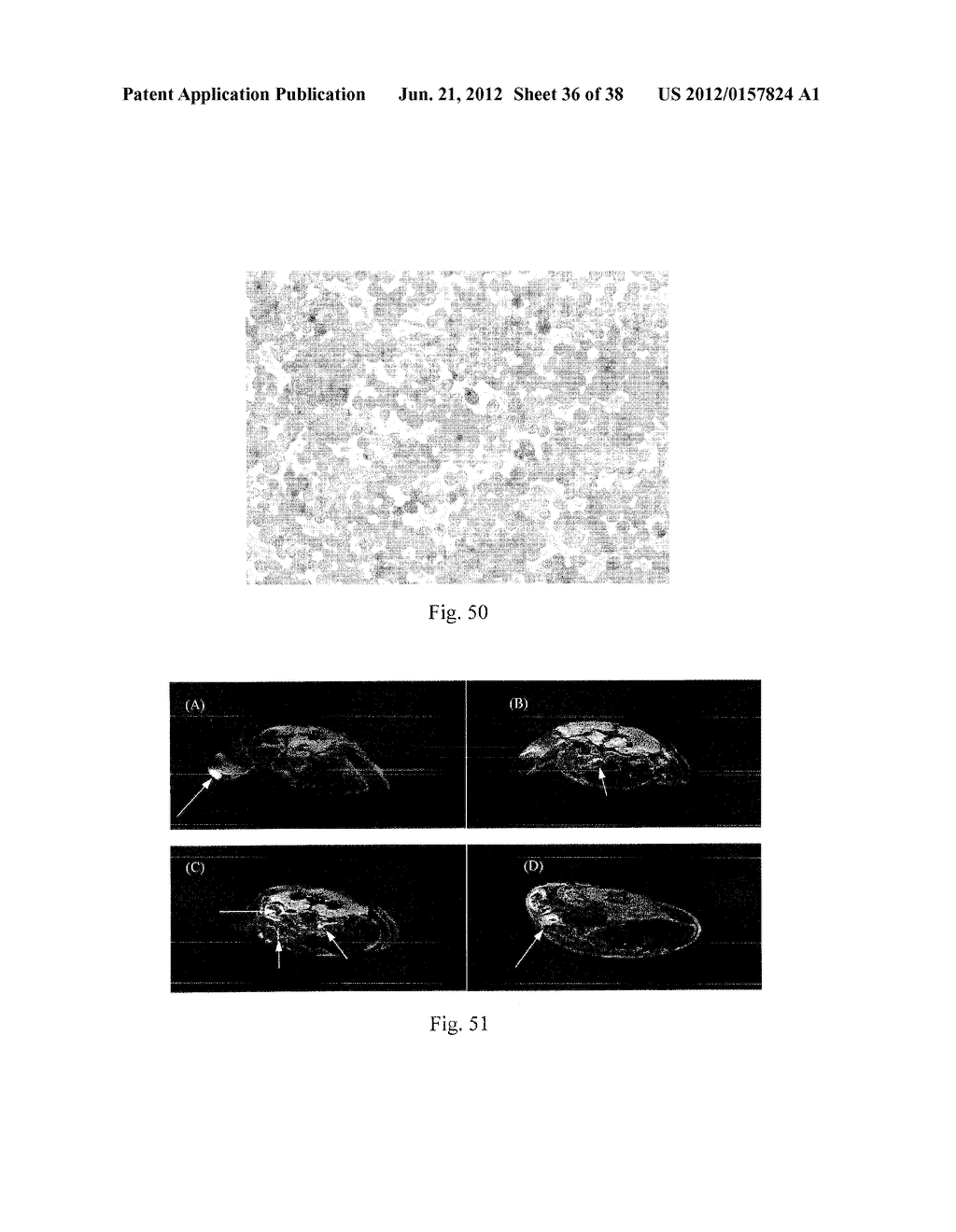 MRI AND OPTICAL ASSAYS FOR PROTEASES - diagram, schematic, and image 37