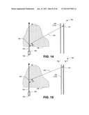 Ablative technique using compton scattered x-ray visualizing, imaging, or     information providing based on matter material density diagram and image