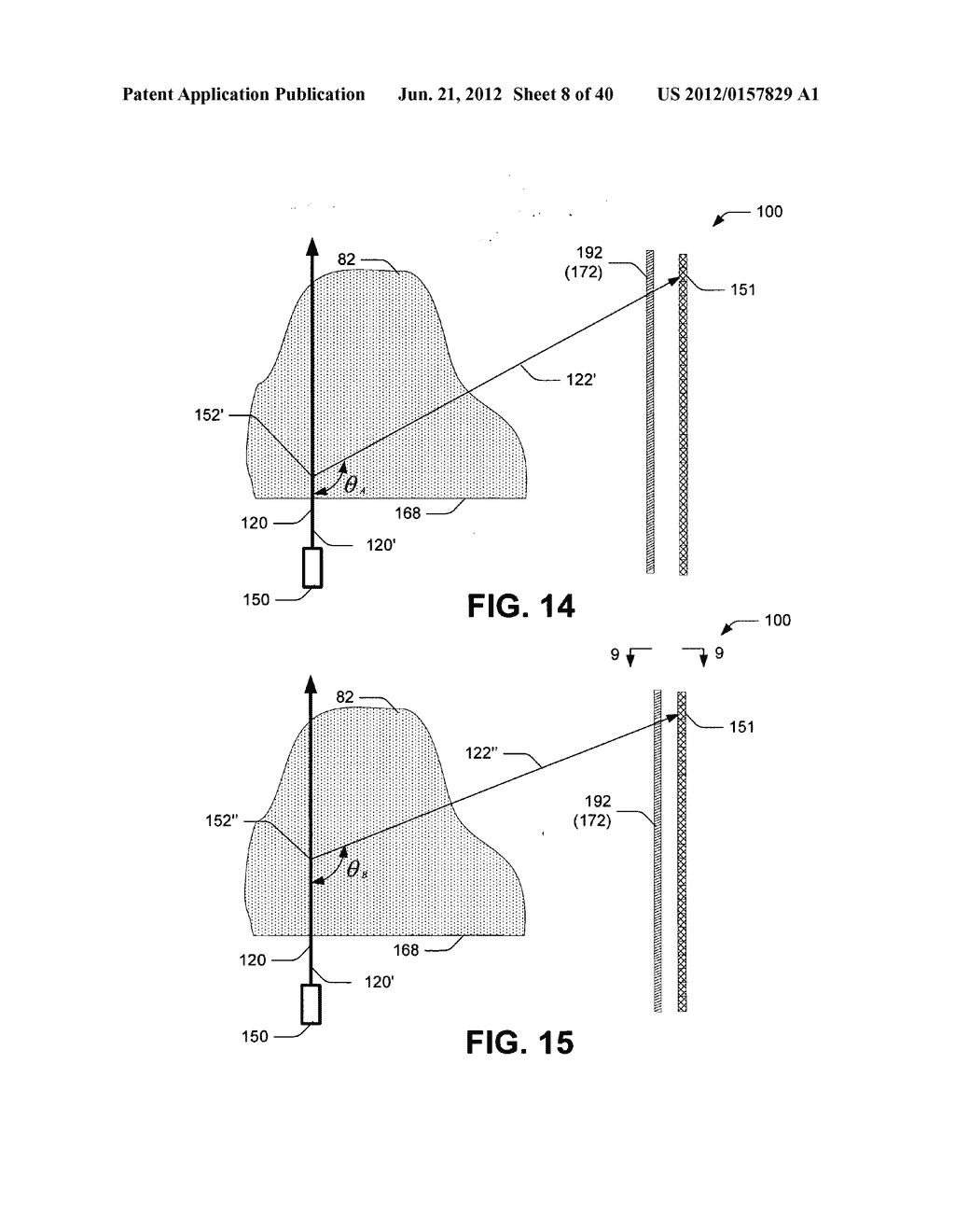 Ablative technique using compton scattered x-ray visualizing, imaging, or     information providing based on matter material density - diagram, schematic, and image 09