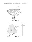 Ablative technique using compton scattered x-ray visualizing, imaging, or     information providing based on matter material density diagram and image