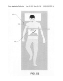 Ablative technique using compton scattered x-ray visualizing, imaging, or     information providing based on matter material density diagram and image