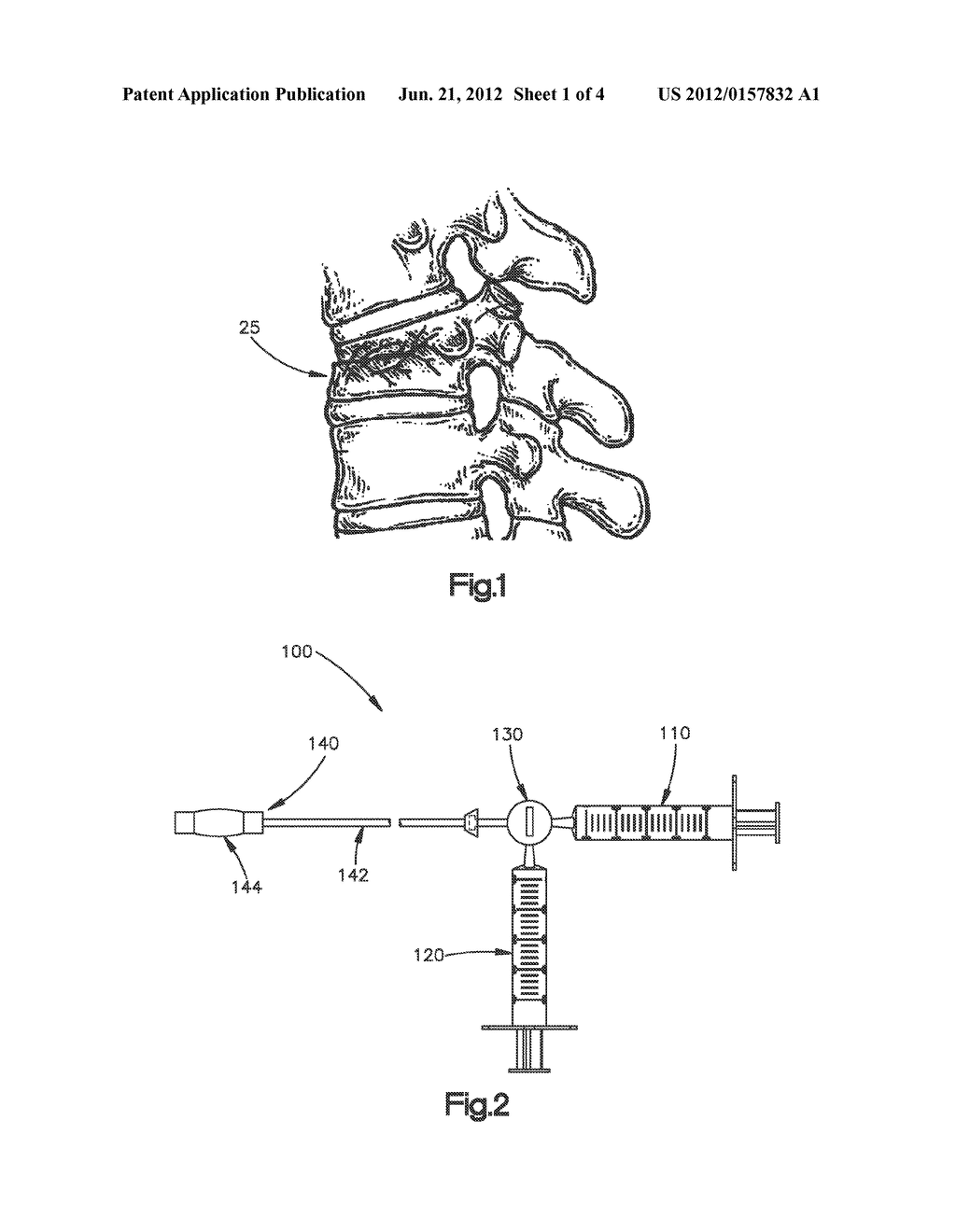 FRACTURE FRAGMENT MOBILITY TESTING FOR VERTEBRAL BODY PROCEDURES - diagram, schematic, and image 02