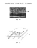 SYSTEMS AND METHODS FOR AUTOMATICALLY IDENTIFYING AND SEGMENTING DIFFERENT     TISSUE TYPES IN ULTRASOUND IMAGES diagram and image