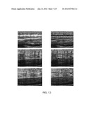 SYSTEMS AND METHODS FOR AUTOMATICALLY IDENTIFYING AND SEGMENTING DIFFERENT     TISSUE TYPES IN ULTRASOUND IMAGES diagram and image