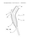 SYSTEM AND METHOD FOR GAINING PERCUTANEOUS ACCESS TO A BODY LUMEN diagram and image