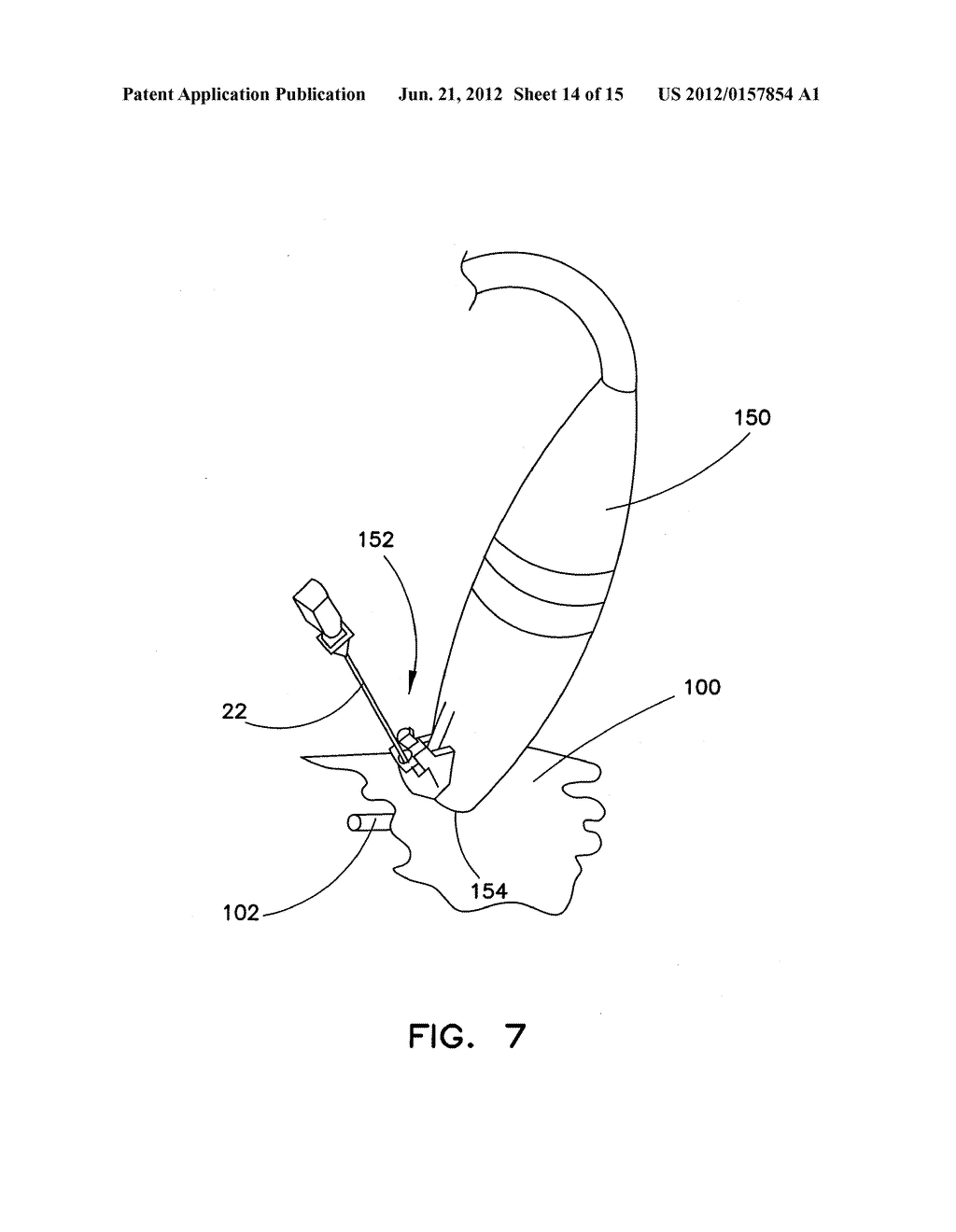 SYSTEM AND METHOD FOR GAINING PERCUTANEOUS ACCESS TO A BODY LUMEN - diagram, schematic, and image 15