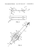 Selectable Eccentric Remodeling and/or Ablation of Atherosclerotic     Material diagram and image