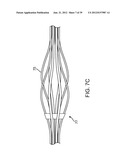 Selectable Eccentric Remodeling and/or Ablation of Atherosclerotic     Material diagram and image