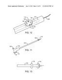 Selectable Eccentric Remodeling and/or Ablation of Atherosclerotic     Material diagram and image