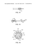 Selectable Eccentric Remodeling and/or Ablation of Atherosclerotic     Material diagram and image