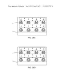 Selectable Eccentric Remodeling and/or Ablation of Atherosclerotic     Material diagram and image