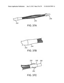 Selectable Eccentric Remodeling and/or Ablation of Atherosclerotic     Material diagram and image