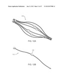 TUNED RF ENERGY FOR SELECTIVE TREATMENT OF ATHEROMA AND OTHER TARGET     TISSUES AND/OR STRUCTURES diagram and image