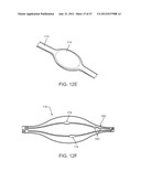 TUNED RF ENERGY FOR SELECTIVE TREATMENT OF ATHEROMA AND OTHER TARGET     TISSUES AND/OR STRUCTURES diagram and image