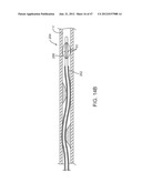 TUNED RF ENERGY FOR SELECTIVE TREATMENT OF ATHEROMA AND OTHER TARGET     TISSUES AND/OR STRUCTURES diagram and image