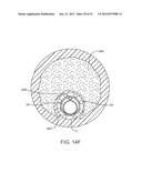 TUNED RF ENERGY FOR SELECTIVE TREATMENT OF ATHEROMA AND OTHER TARGET     TISSUES AND/OR STRUCTURES diagram and image